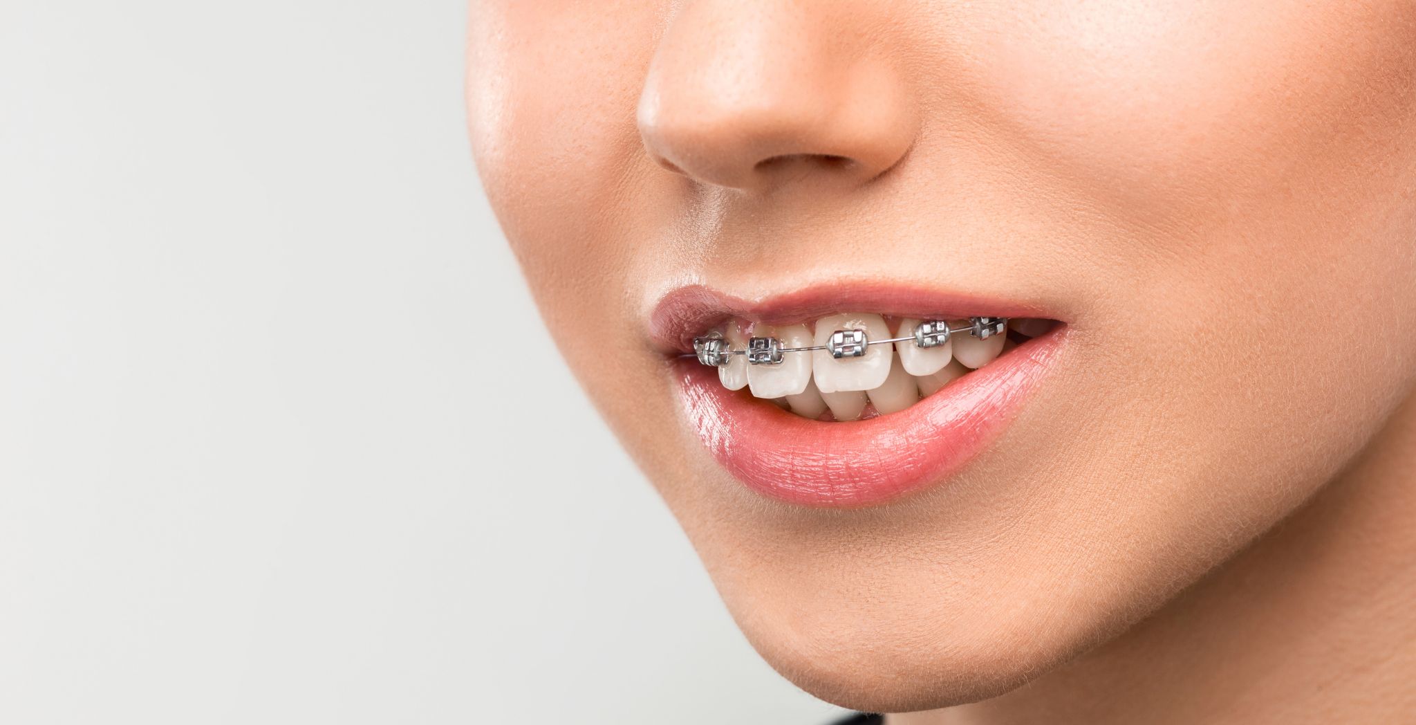 Underbite vs overbite, Underbite vs overbite vs normal, How to fix overbite