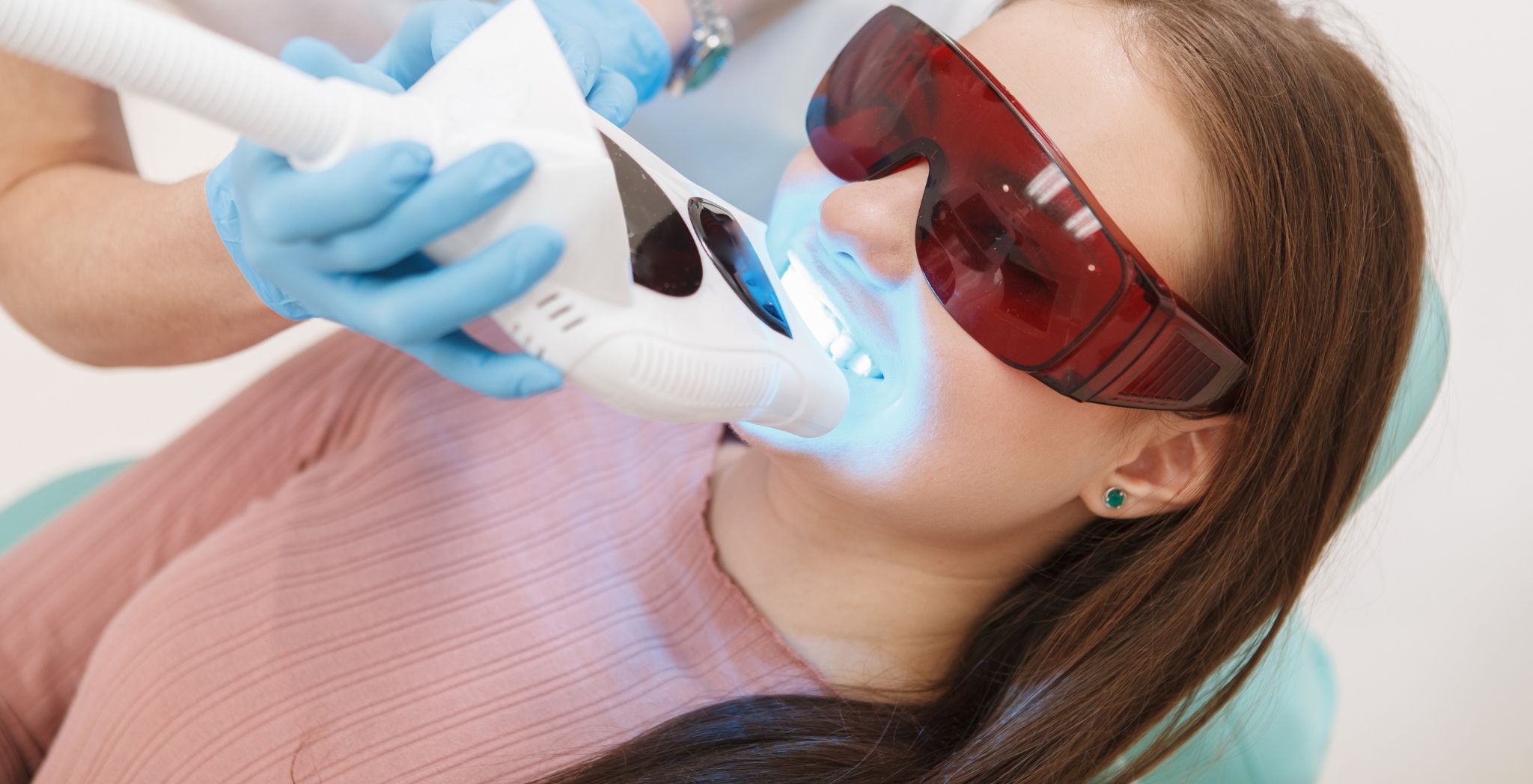 Laser teeth whitening procedure, Benefits of laser teeth whitening